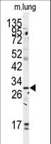 GOLPH3 Antibody (aa251-279)