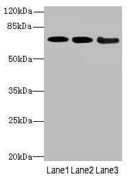 Polyclonal Rabbit anti-Human COL9A3 / Collagen IX Antibody (IHC, WB)