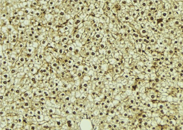 Polyclonal Rabbit anti-Human ROGDI Antibody (IHC, WB)