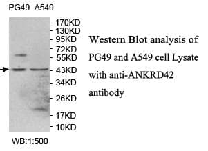 ANKRD42 Antibody (N-Terminus)