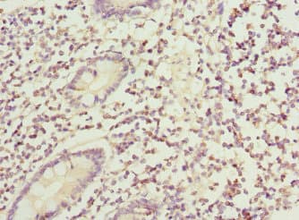 Polyclonal Rabbit anti-Human BAR / BFAR Antibody (IHC)
