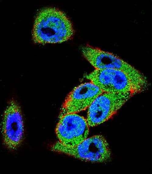 DVL3 / Dishevelled 3 Antibody (aa530-557)
