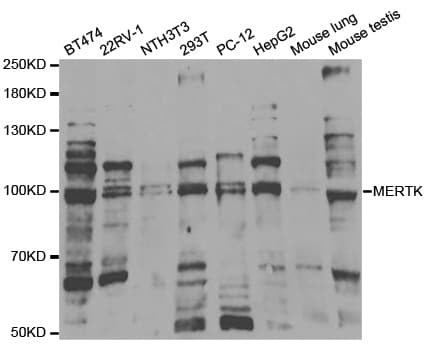 MER / MERTK Antibody