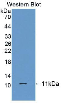 HOPX / HOP Antibody (aa10-73)