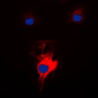 Polyclonal Rabbit anti-Human MARK2 Antibody (Internal, IHC, IF, WB)