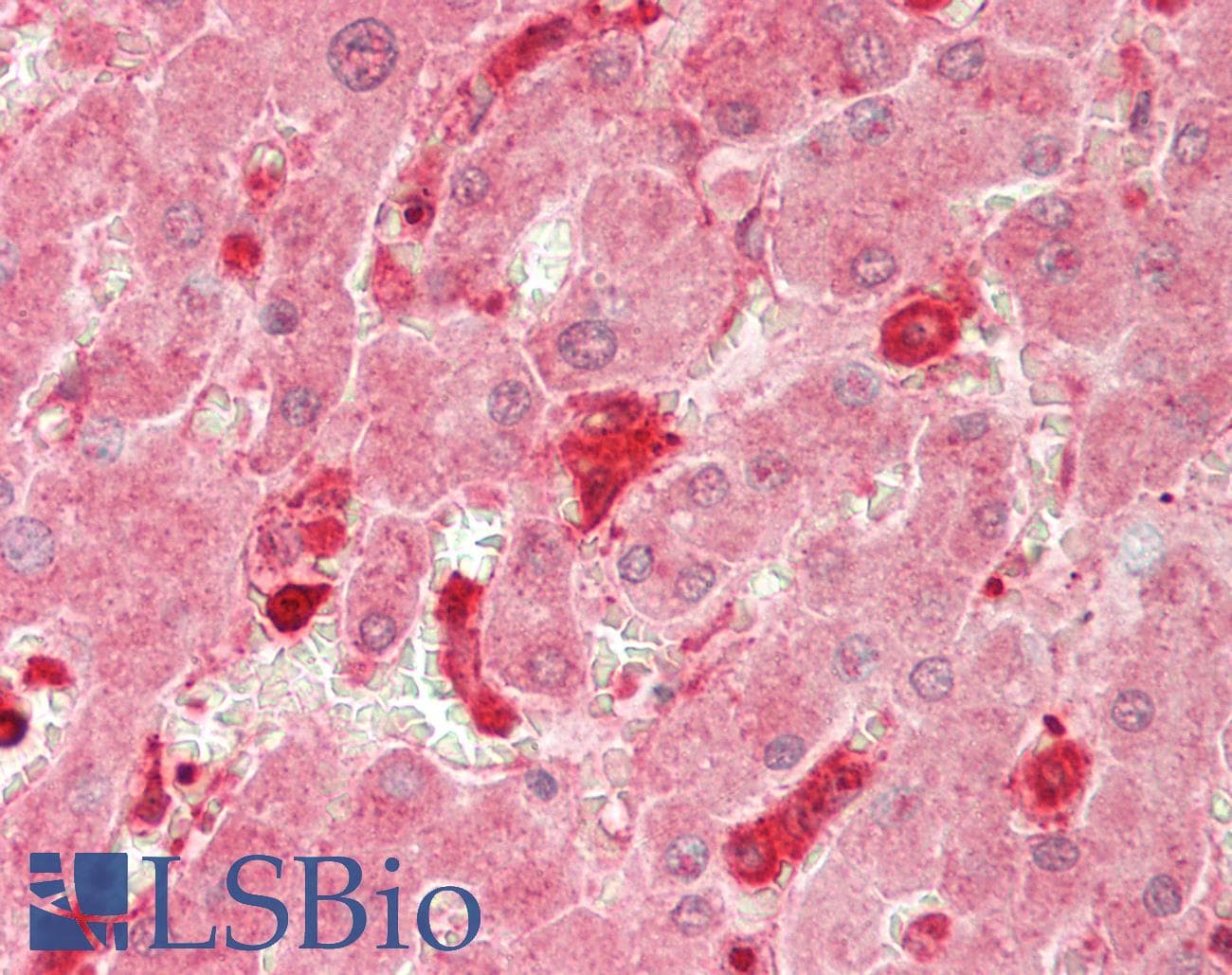 MTMR12 Antibody (C-Terminus)
