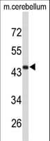 Polyclonal Rabbit anti-Human FMOD / Fibromodulin Antibody (aa337-364, IHC, WB)