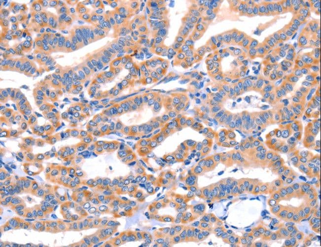 AP1B1 / BAM22 Antibody