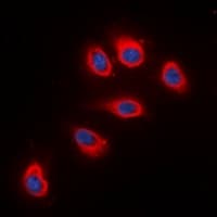 RPS6 / Ribosomal Protein S6 Antibody (C-Terminus)