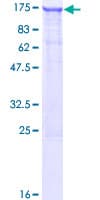 Human LIMCH1 Protein (Recombinant GST)