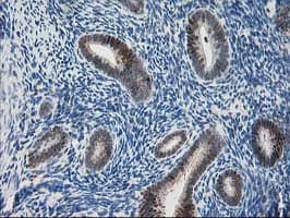 PDXK / PNK Antibody (clone OTI5H5)