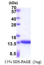 Human CRIP1 Protein (Recombinant His)