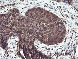 TRAIP / TRIP Antibody (aa67-313, clone OTI2D4, Carrier-free)