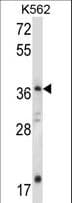 JMJD6 / PSR Antibody (aa284-311)