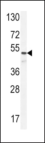 Polyclonal Rabbit anti-Human ANGPT1 / Angiopoietin-1 Antibody (aa374-402, WB)