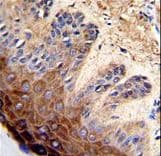 TOP2A / Topoisomerase II Alpha Antibody (aa1167-1196)