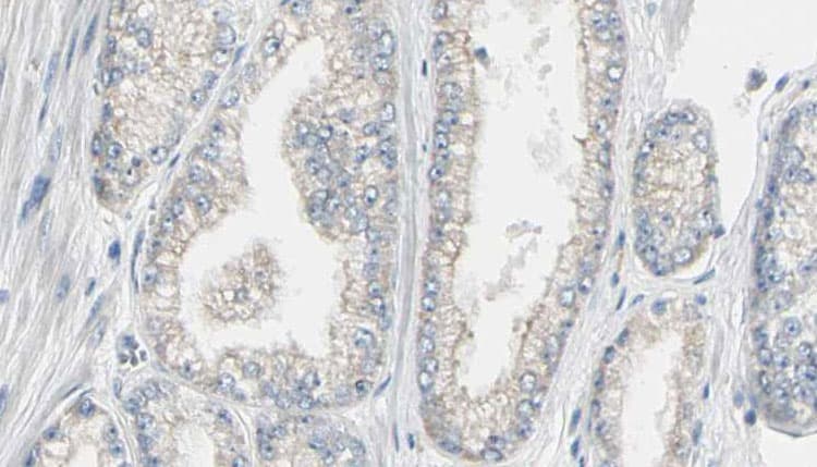 Polyclonal Rabbit anti-Human CALM3 / Calmodulin 3 Antibody (phospho-Thr79,phospho-Ser81, IHC, IF, WB)