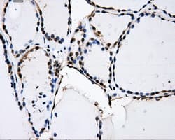 PKMYT1 Antibody (clone OTI5E1)