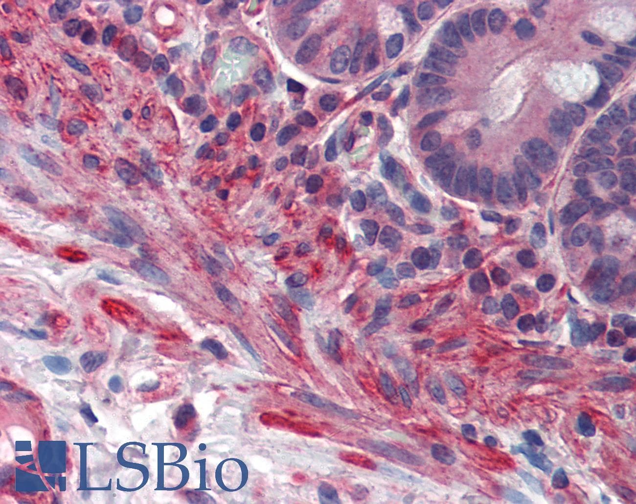 PRDM5 Antibody (aa36-85)