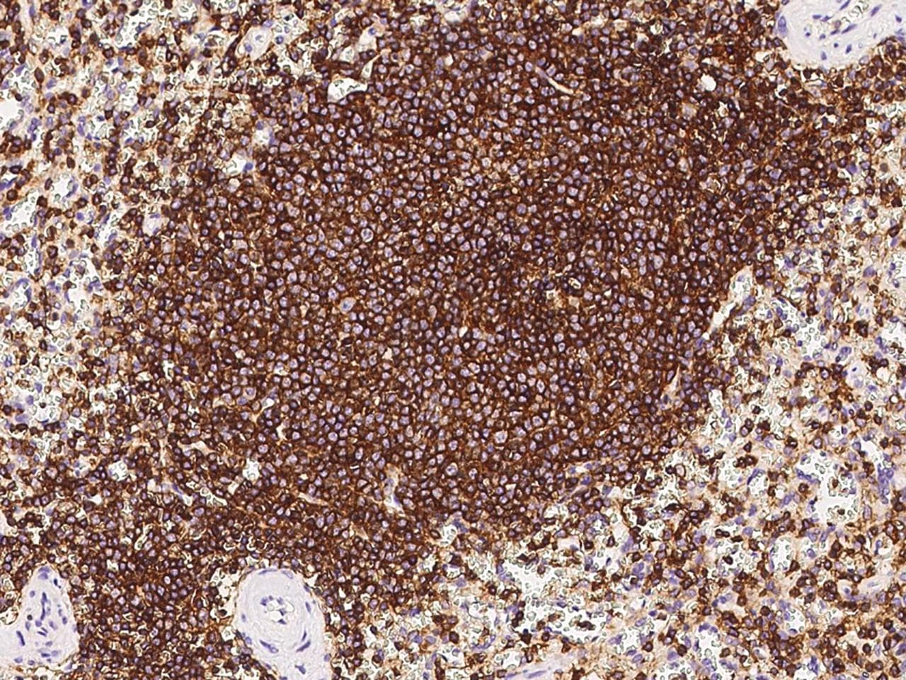 Monoclonal Mouse anti-Human CD45 / LCA Antibody (clone 20, Preservative Free, IHC, WB)