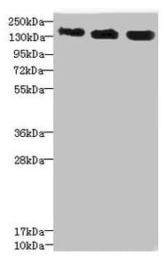 Polyclonal Rabbit anti-Human ANKS1B Antibody (IHC, WB)