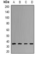 UCHL5 / UCH37 Antibody