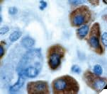 Monoclonal Mouse anti-Human Thyrotropin / TSH Antibody (Ready-to-Use, IHC)