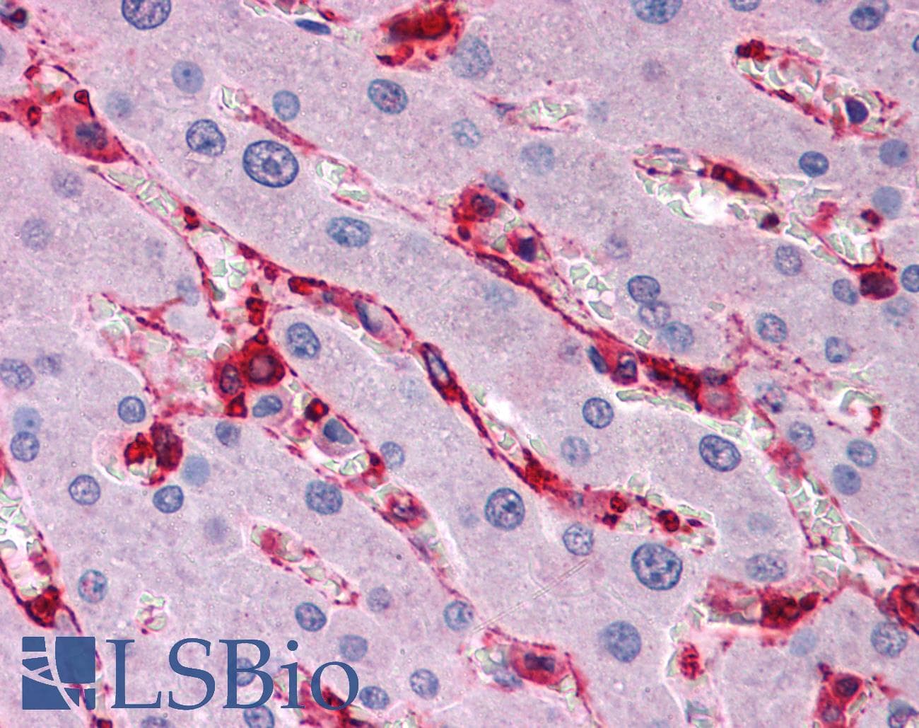 IHC-plus™ Polyclonal Rabbit anti-Human FLNA / Filamin A Antibody (IHC, IF, WB)