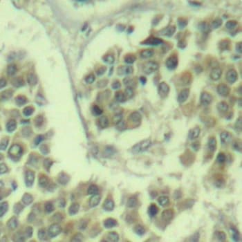EIF2S1 Antibody (phospho-Ser49)
