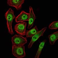 Monoclonal Mouse anti-Human KDM4A / JHDM3A / JMJD2A Antibody (clone 5H1, IHC, IF, WB)