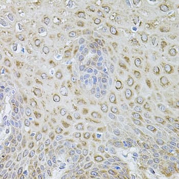 CYBB / NOX2 / gp91phox Antibody