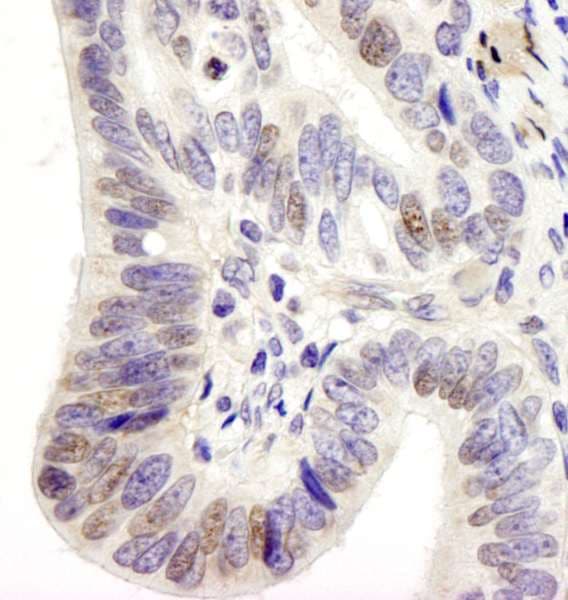 USP28 Antibody (aa50-100)