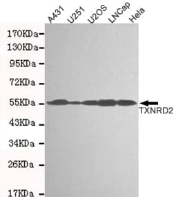 Monoclonal Mouse anti-Human TXNRD2 Antibody (WB)