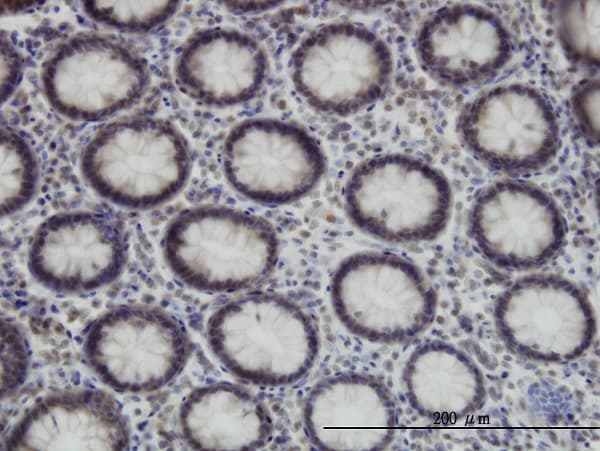 Monoclonal Mouse anti-Human SPT5 / SUPT5H Antibody (clone 3F1, IHC, IF, WB)