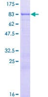 Human EIF2A / EIF2 Alpha Protein (Recombinant GST)