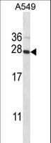 POLR2E Antibody (aa30-59)