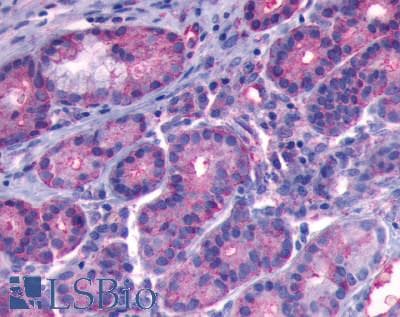 PathPlus™ Polyclonal Rabbit anti-Human B1R / BDKRB1 Antibody (C-Terminus, IHC)