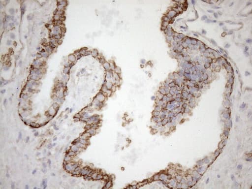 Monoclonal Mouse anti-Human KRT16 / CK16 / Cytokeratin 16 Antibody (clone OTI1G1, IHC, WB)