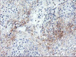SPINT1 / HAI-1 Antibody (clone OTI1E2)