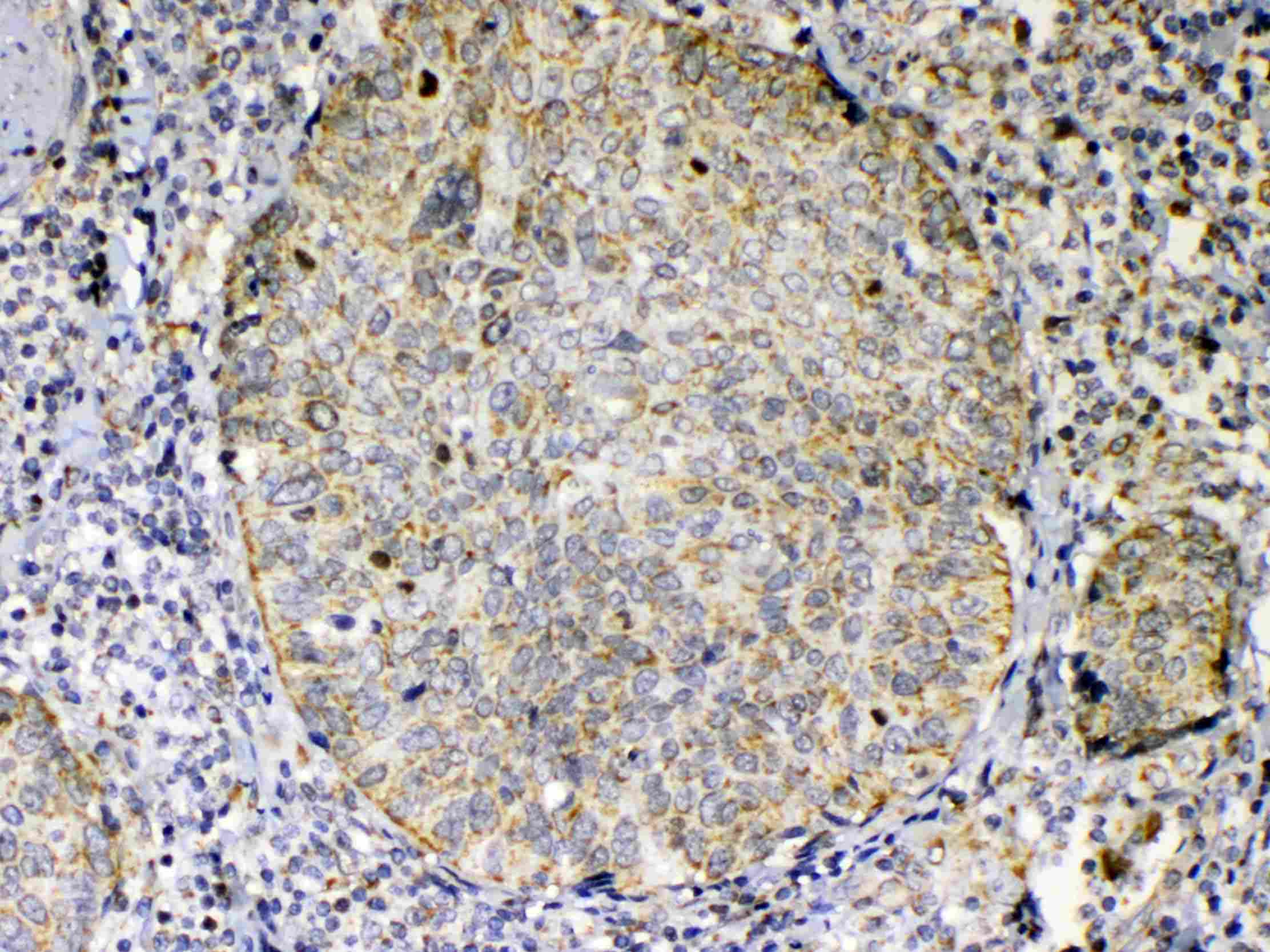 Polyclonal Rabbit anti-Human TNFSF18 / GITRL Antibody (IHC, WB)