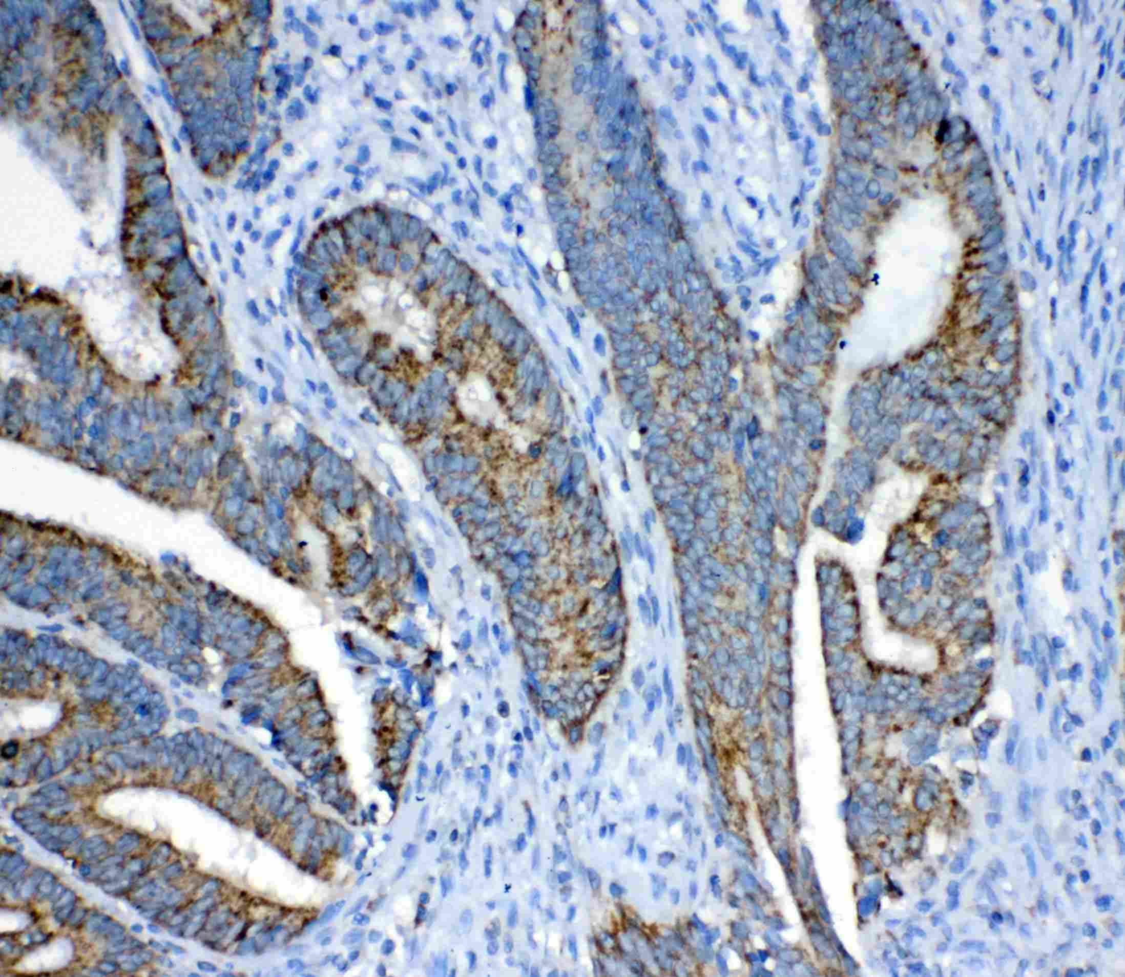 Polyclonal Rabbit anti-Human FH / Fumarase / MCL Antibody (IHC, WB)