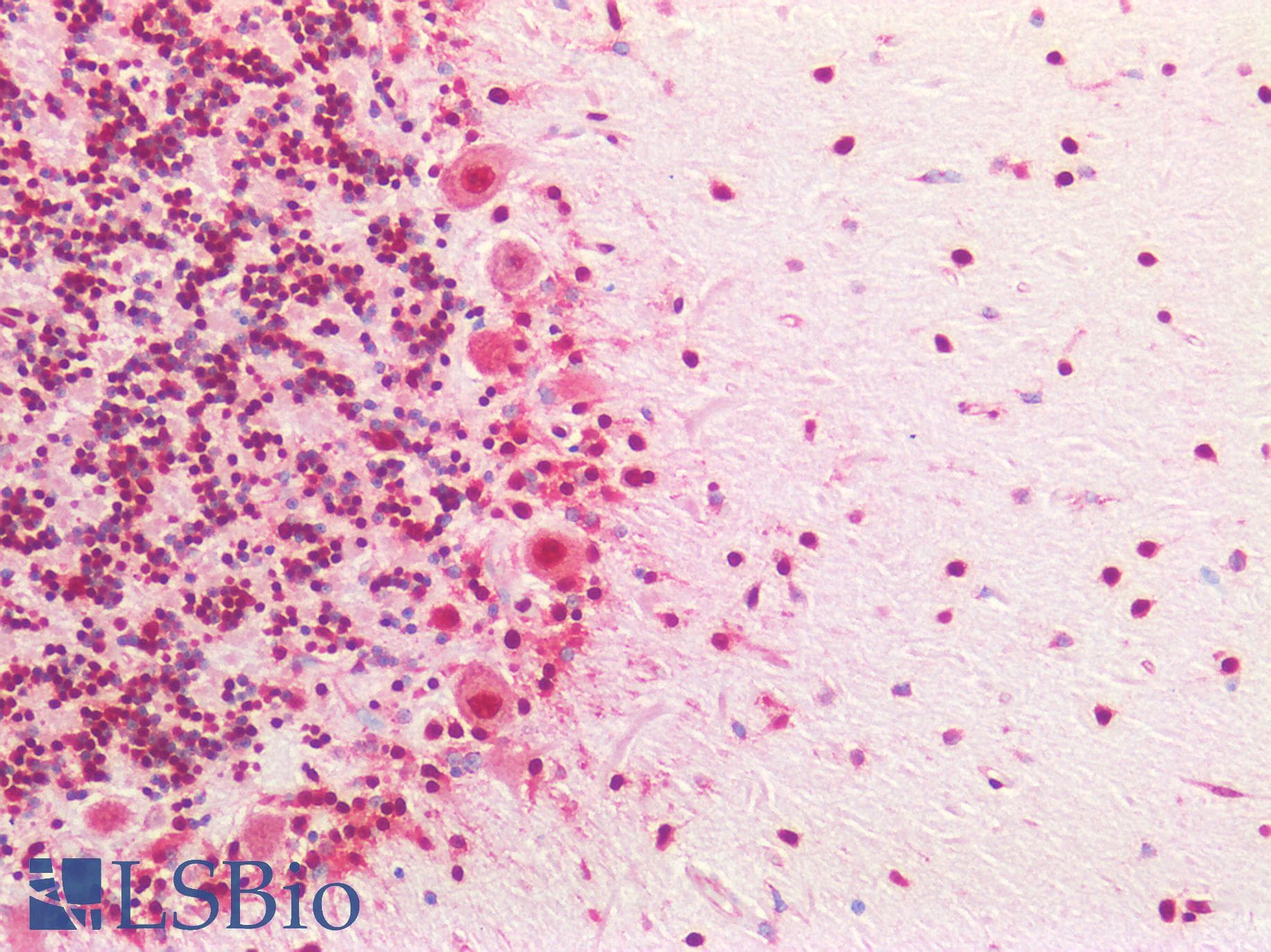 PathPlus™ Monoclonal Mouse anti-Human PLEKHG5 Antibody (clone 5A9, IHC, IF, WB)