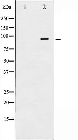 INSR / Insulin Receptor Antibody (phospho-Tyr1361)