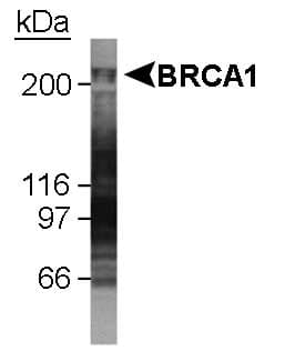 BRCA1 Antibody (aa1314-1864, clone KEN, DY488)