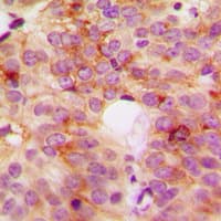 ACOT8 Antibody (Internal)