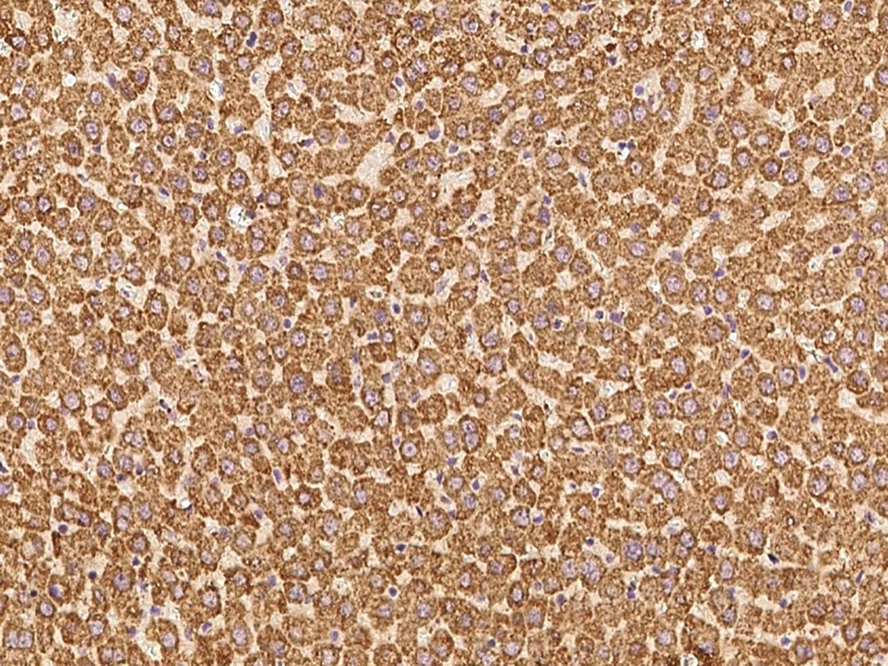 VDAC1 / PORIN Antibody (Preservative Free)