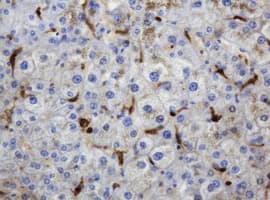 TP / Thymidine Phosphorylase Antibody (clone OTI1H7)