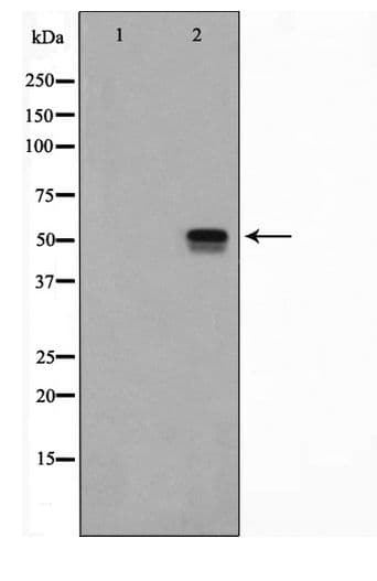 Polyclonal Rabbit anti-Human TP53 / p53 Antibody (IHC, IF, WB)