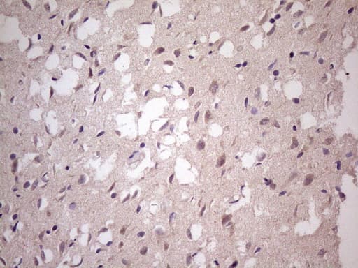 TBC1D28 Antibody (clone OTI4A9, Carrier-free)