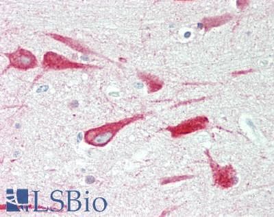 PathPlus™ CANX / Calnexin Antibody (aa543-592)